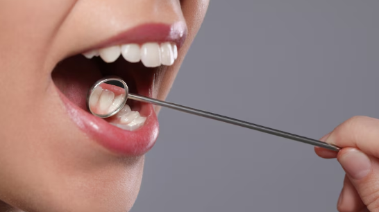 5 Health Tips for Taking Care of Your Teeth 5 Health Tips for Taking Care of Your Teeth